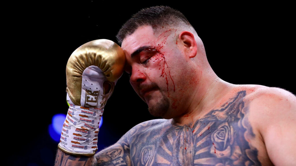 Andy Ruiz Jr in boxing ring with blood from eye showing fierce determination and strength Wallpaper