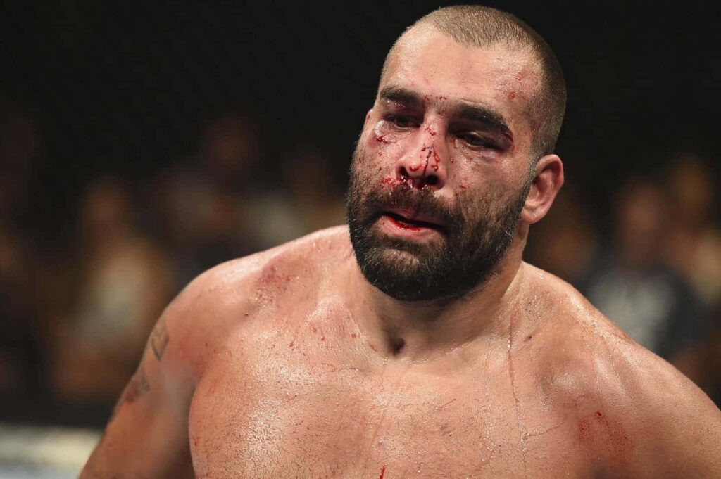 Blagoy Ivanov intense MMA fighter bloodied face and shoulders in ring after tough fight wallpaper