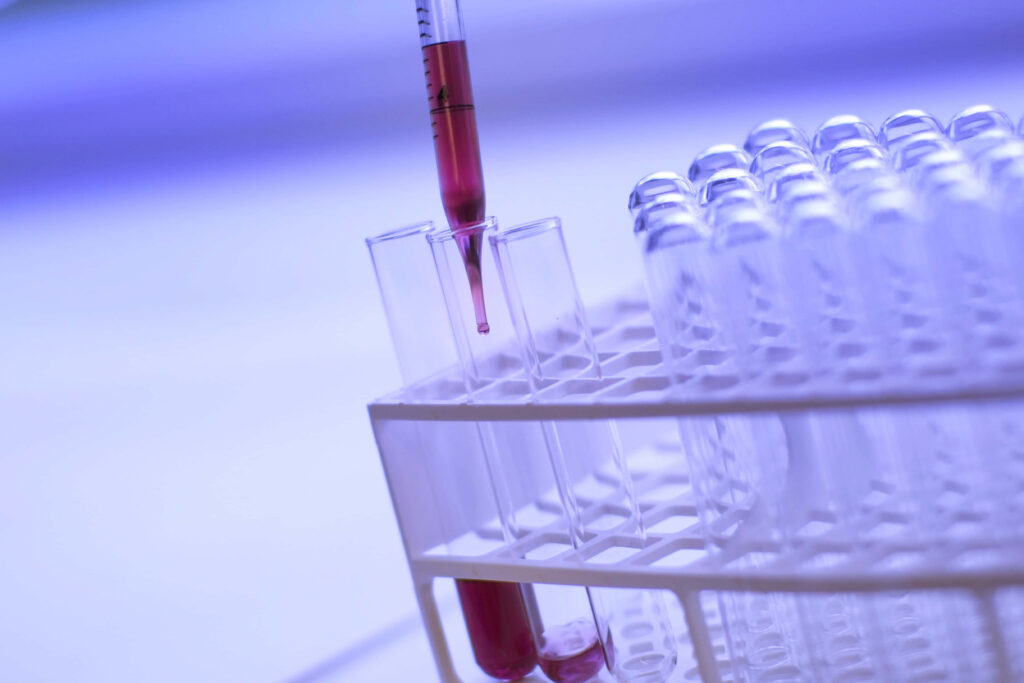 Close-up of pipette dispensing red liquid into test tube surrounded by glass tubes in lab rack Wallpaper