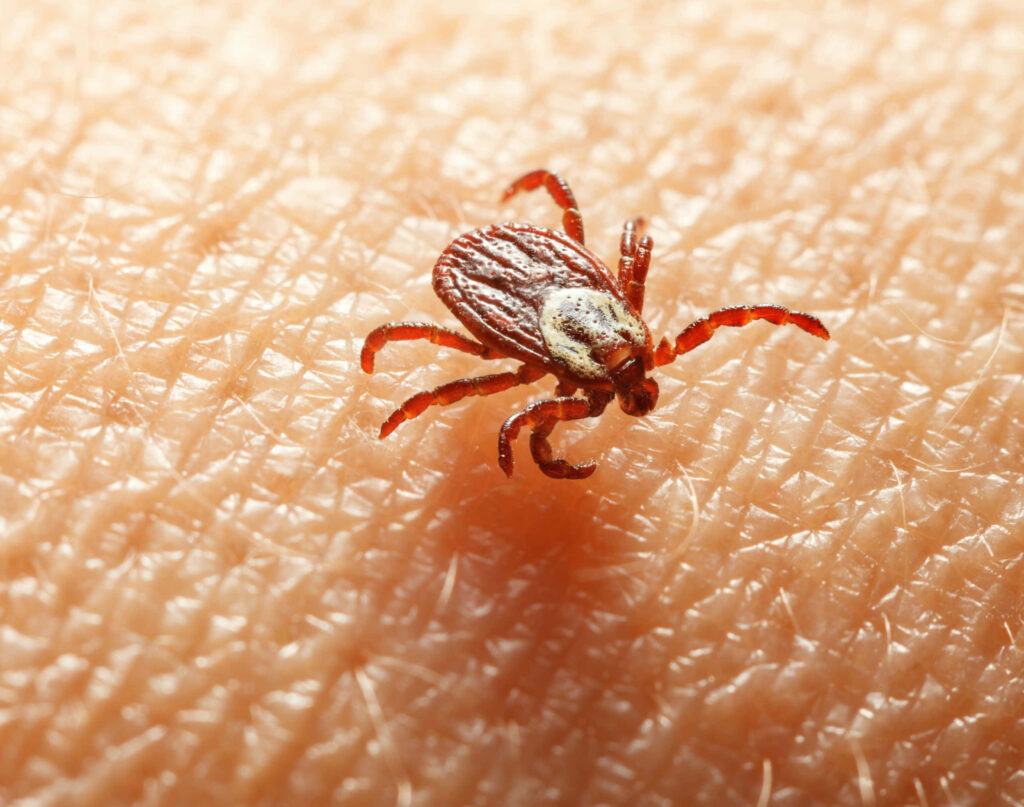 Close-Up of Tick on Skin: Detailed Features & Texture Wallpaper