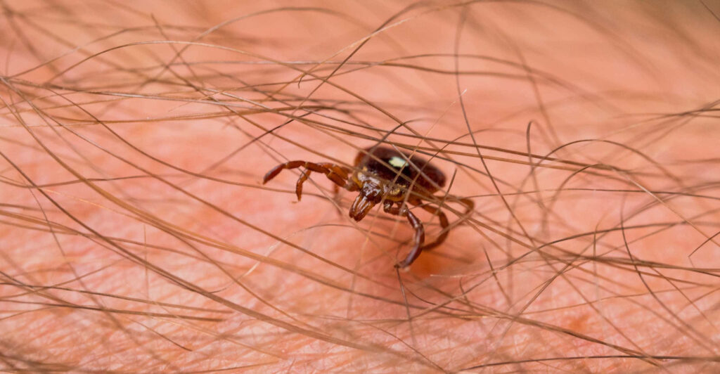 Detailed Close-Up of Tick on Skin – Nature Wallpaper Background