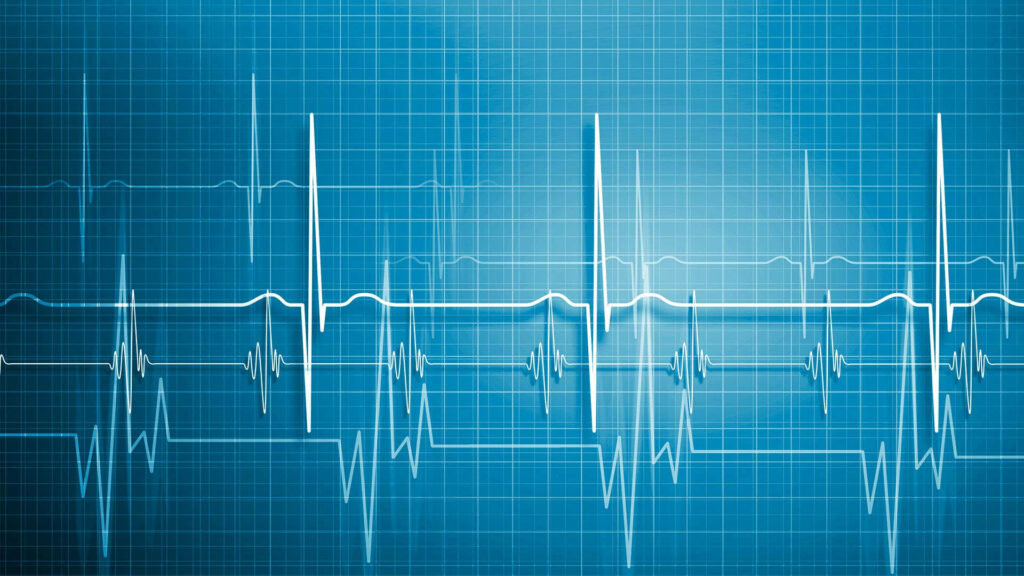 Medical Professionals' Expertly Analyzed Visual Display of Normal Heartbeat Patterns Wallpaper