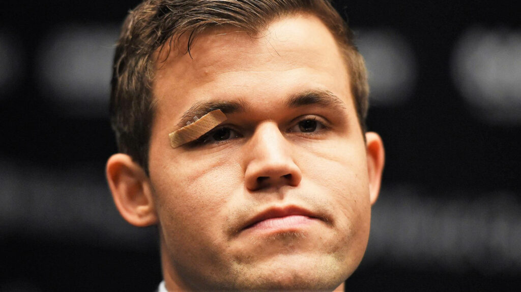 Magnus Carlsen Wallpaper: Eye Injury & Bandage Against Dark Background