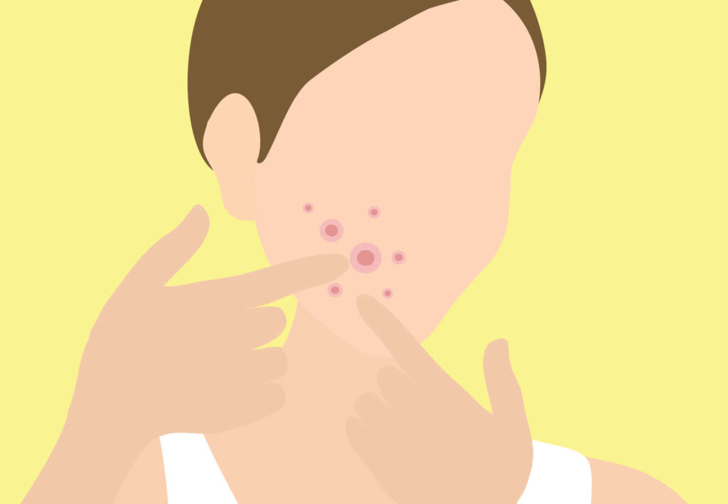 Minimalist Yellow Wallpaper: Person with Pimples Illustration