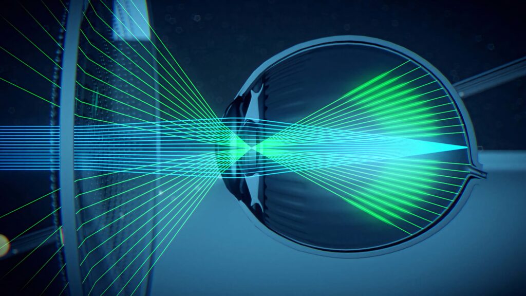 Detailed cross-section of myopic eye with vibrant blue and green lighting futuristic medical design Wallpaper