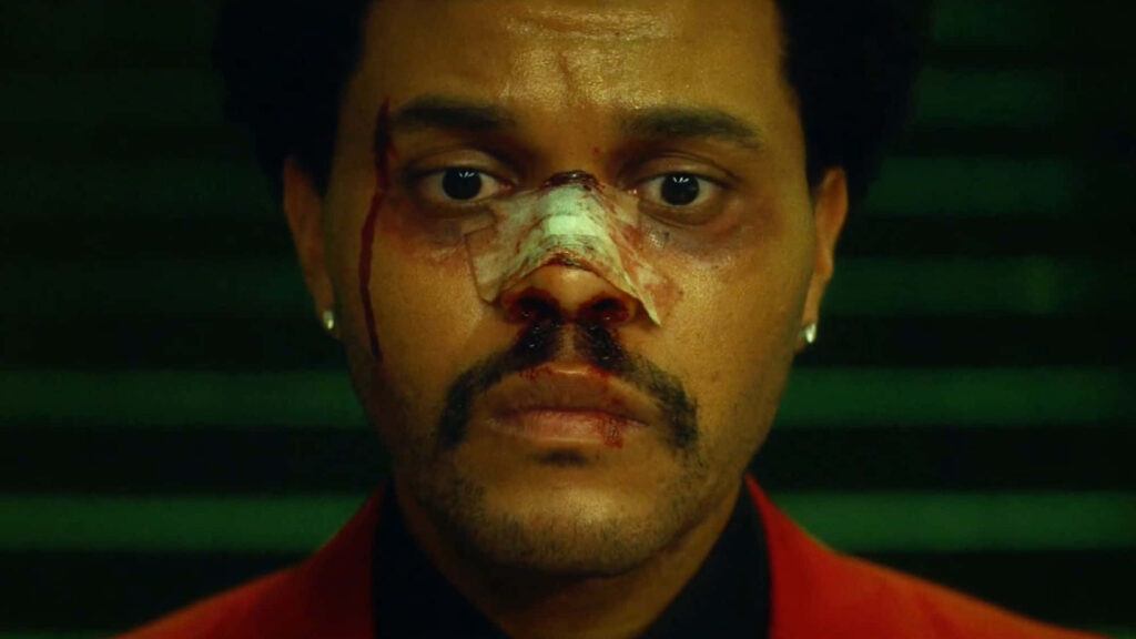 Intense Weeknd After Hours Wallpaper: Dark Bruised Close-Up